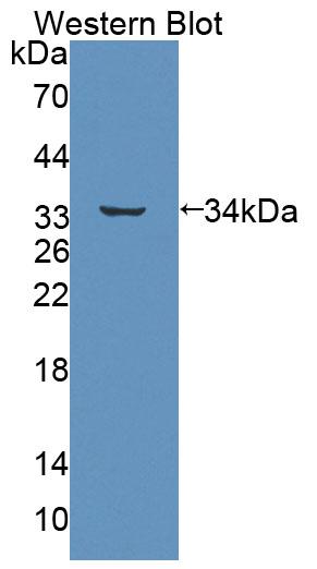 Polyclonal Antibody to ATP Binding Cassette Transporter B7 (B7)