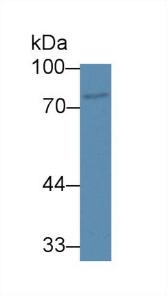 Polyclonal Antibody to ATP Binding Cassette Transporter B8 (B8)