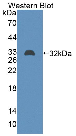 Polyclonal Antibody to ATP Binding Cassette Transporter B9 (B9)