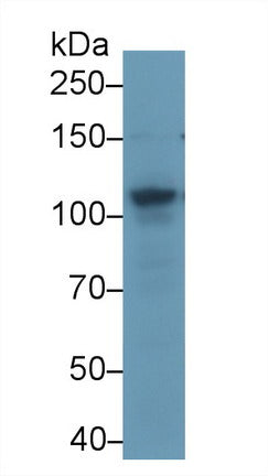 Polyclonal Antibody to ATP Binding Cassette Transporter F1 (F1)