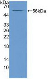 Polyclonal Antibody to ATP Binding Cassette Transporter A13 (A13)