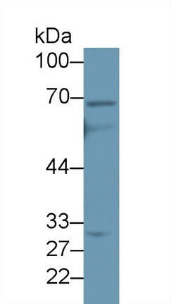 Polyclonal Antibody to ATP Binding Cassette Transporter D4 (D4)