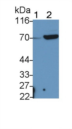 Polyclonal Antibody to ATP Binding Cassette Transporter G5 (G5)