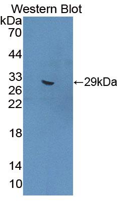 Polyclonal Antibody to Methylcrotonoyl Coenzyme A Carboxylase 1 (MCCC1)