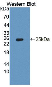 Polyclonal Antibody to Pyruvate Dehydrogenase Phosphatase 2 (PDP2)