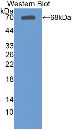Polyclonal Antibody to Lipolysis Stimulated Lipoprotein Receptor (LSR)
