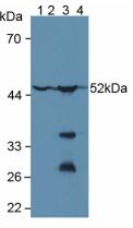Polyclonal Antibody to Glutathione Synthetase (GSS)