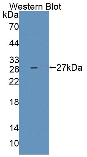 Polyclonal Antibody to Phospholipase C Like Protein 1 (PLCL1)