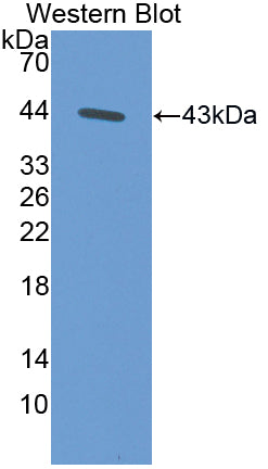 Polyclonal Antibody to Aspartate Aminotransferase 2 (AST2)