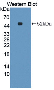 Polyclonal Antibody to Cysteine Conjugate Beta Lyase, Cytoplasmic (CCbL1)