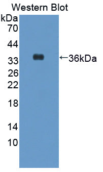 Polyclonal Antibody to Glutamine Fructose-6-Phosphate Transaminase 2 (GFPT2)