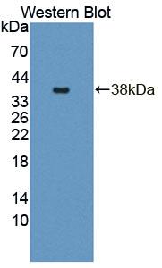 Polyclonal Antibody to Glutamine Fructose-6-Phosphate Transaminase 1 (GFPT1)