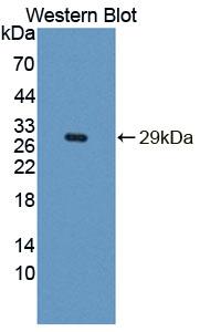 Polyclonal Antibody to Insulin Receptor Substrate 4 (IRS4)