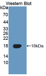 Polyclonal Antibody to Tumor Necrosis Factor Receptor Superfamily, Member 19 (TNFRSF19)