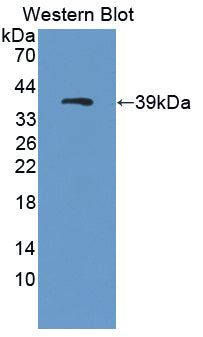 Polyclonal Antibody to Protocadherin Gamma A2 (PCDHgA2)