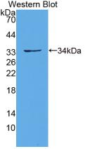 Polyclonal Antibody to Protocadherin 15 (PCDH15)