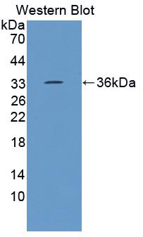 Polyclonal Antibody to Ephrin Type B Receptor 3 (EPHB3)