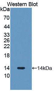 Polyclonal Antibody to Procollagen Lysine-2-Oxoglutarate-5-Dioxygenase 3 (PLOD3)