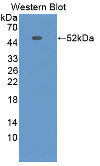 Polyclonal Antibody to Ras Homolog Gene Family, Member Q (RHOQ)