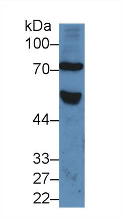 Polyclonal Antibody to Frizzled Homolog 1 (FZD1)