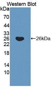 Polyclonal Antibody to Huntingtin Interacting Protein 2 (HIP2)