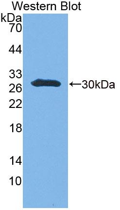 Polyclonal Antibody to Ubiquitin Conjugating Enzyme E2S (UBE2S)