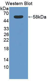 Polyclonal Antibody to Tubulin Epsilon (TUBe)
