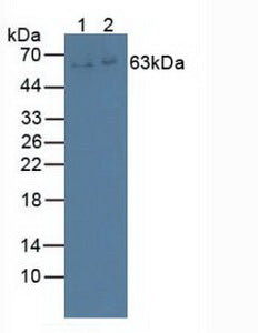 Polyclonal Antibody to Interleukin 22 Receptor (IL22R)