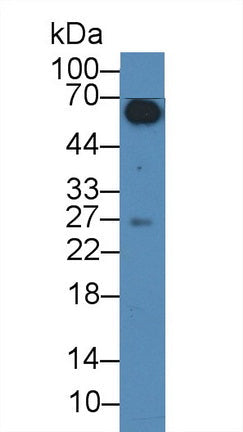 Polyclonal Antibody to Immunoglobulin A1 (IgA1)