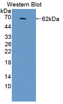 Polyclonal Antibody to Glutamate Receptor, Ionotropic, AMPA 2 (GRIA2)