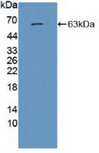 Polyclonal Antibody to Glutamate Receptor, Ionotropic, N-Methyl-D-Aspartate 2A (GRIN2A)