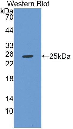 Polyclonal Antibody to Calcium Channel, Voltage Dependent, L-Type, Alpha 1C Subunit (CACNa1C)