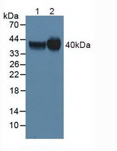 Polyclonal Antibody to Folate Receptor 1, Adult (FOLR1)