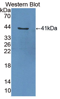 Polyclonal Antibody to Centaurin Alpha 2 (CENTa2)