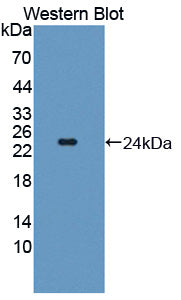 Polyclonal Antibody to Twisted Gastrulation Protein Homolog 1 (TWSG1)