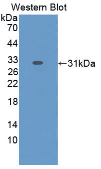 Polyclonal Antibody to Glycine Dehydrogenase (GLDC)