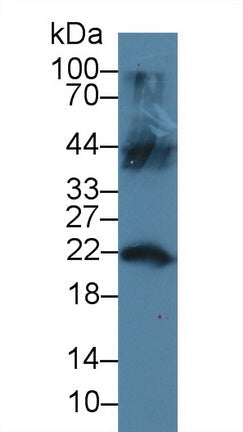 Polyclonal Antibody to Lipocalin 12 (LCN12)