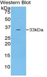 Polyclonal Antibody to Receptor Tyrosine Kinase Like Orphan Receptor 1 (ROR1)