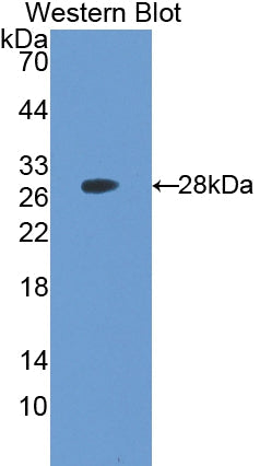 Polyclonal Antibody to Ubiquitin Carboxyl Terminal Hydrolase L3 (UCHL3)