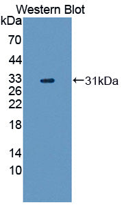 Polyclonal Antibody to Transformation/Transcription Domain Associated Protein (TRRAP)