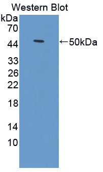 Polyclonal Antibody to Toll Like Receptor Adaptor Molecule 2 (TICAM2)