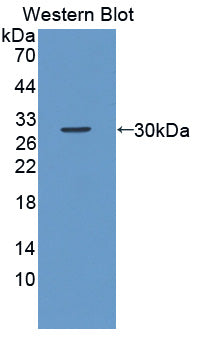 Polyclonal Antibody to SRSF Protein Kinase 2 (SRPK2)