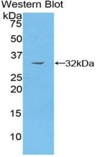 Polyclonal Antibody to p21 Protein Activated Kinase 4 (PAK4)