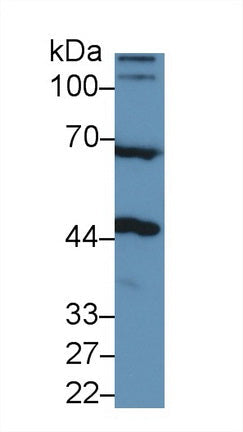 Polyclonal Antibody to N-Acetylgalactosaminidase Alpha (NAGa)