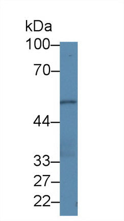 Polyclonal Antibody to Pleckstrin Homology Domain Containing Family A, Member 1 (PLEKHA1)