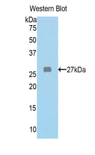 Polyclonal Antibody to Fumarylacetoacetate Hydrolase (FAH)