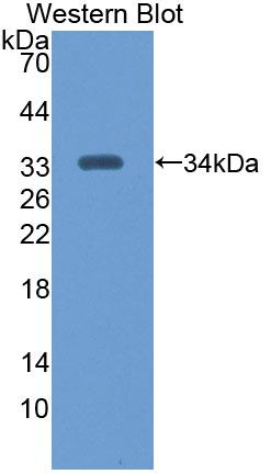 Polyclonal Antibody to Chitinase 1 (CHIT1)