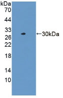 Polyclonal Antibody to Lactamase Beta (LACTb)