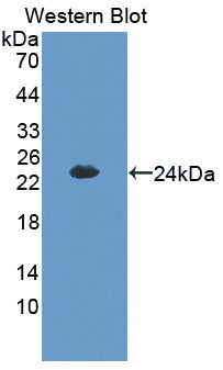 Polyclonal Antibody to Cbp/p300 Interacting Transactivator, With Glu/Asp Rich Carboxy Terminal Domain 1 (CITED1)