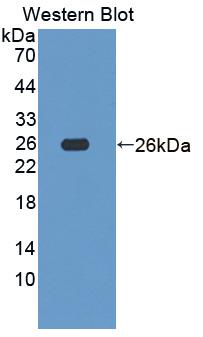 Polyclonal Antibody to NADH Dehydrogenase Ubiquinone Fe-S Protein 1 (NDUFS1)